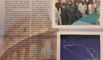 Nuovi device al San Filippo Neri per la cura dell'insufficienza mitralica del difetto interatriale