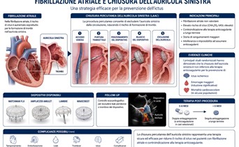 Fibrillazione atriale e chiusura percutanea dell’auricola sinistra: stato dell’arte e prospettive future